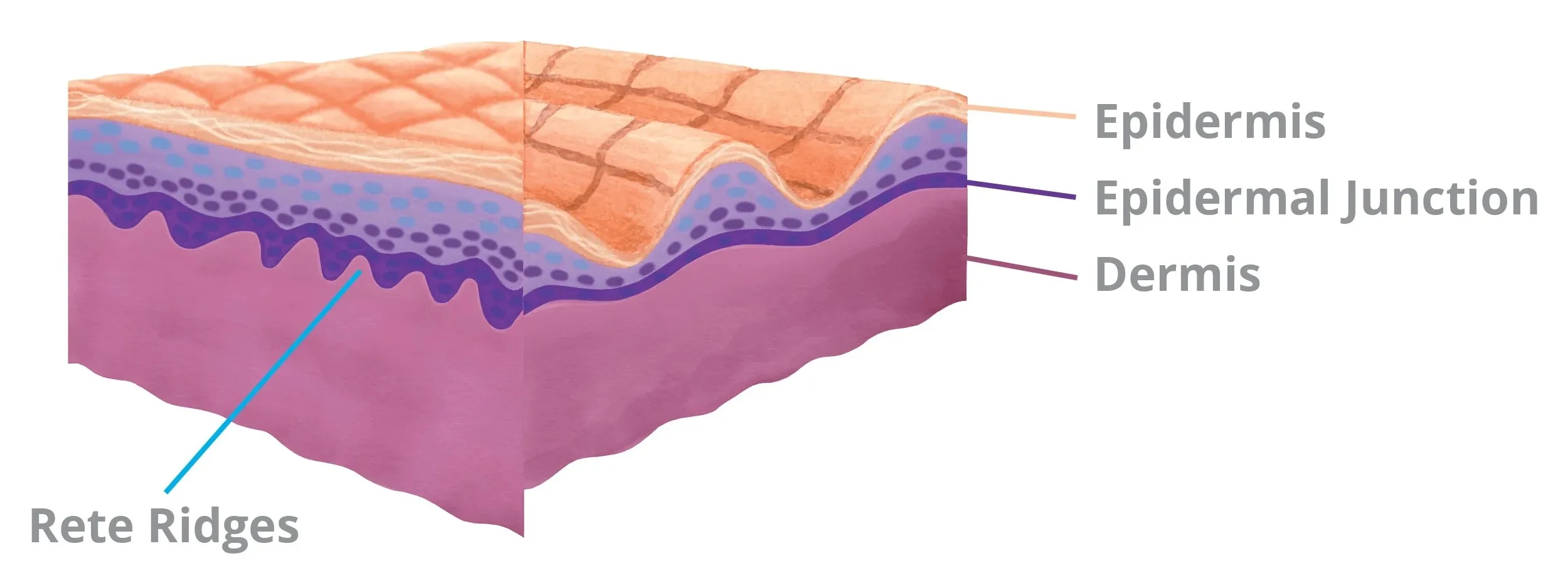 Dermal-epidermal junction